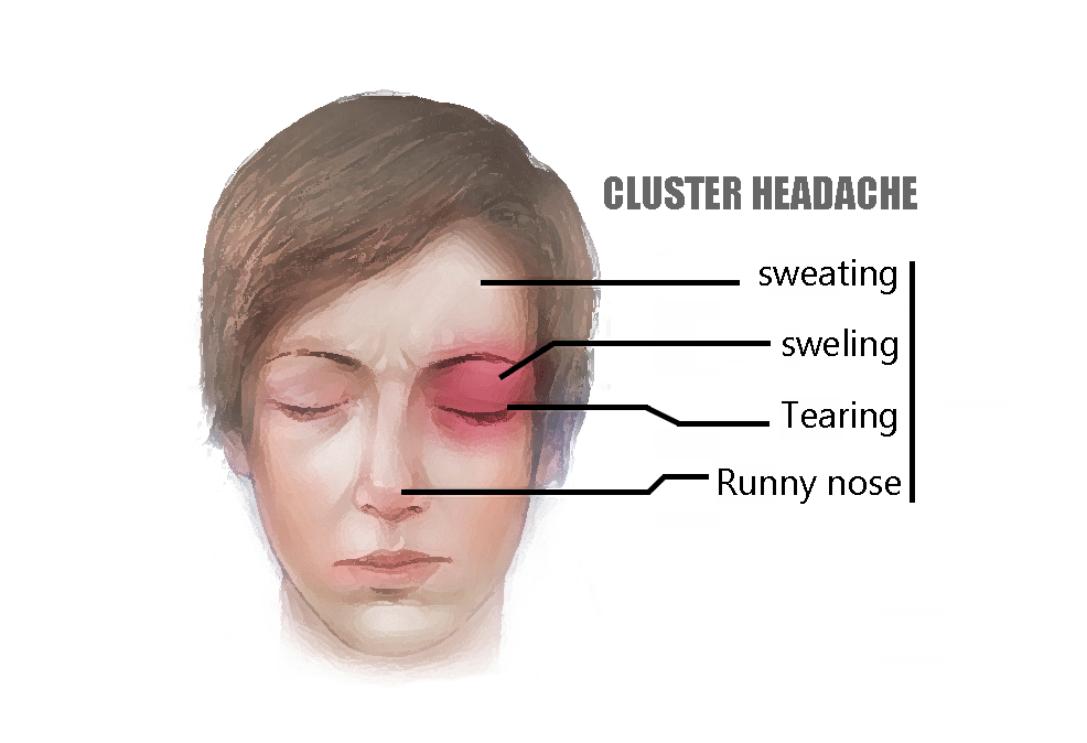 headaches in the back of the head and right eye
