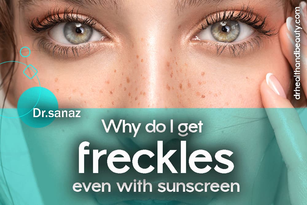 Why do I get freckles even with sunscreen?