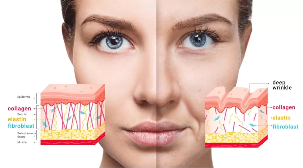How To Prevent Face Wrinkles When Losing Weight