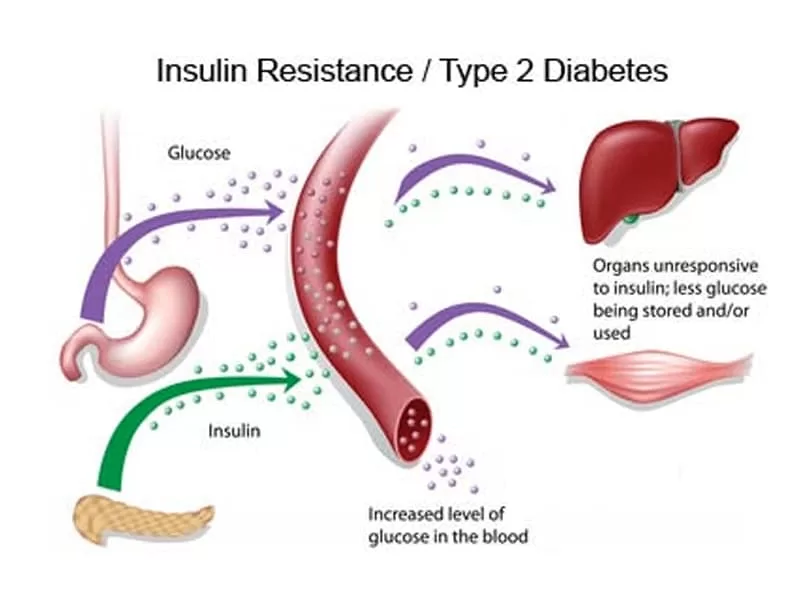 Insulin-resistance