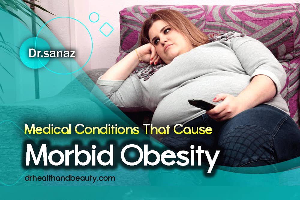 Medical-Conditions-That-Cause-Morbid-Obesity