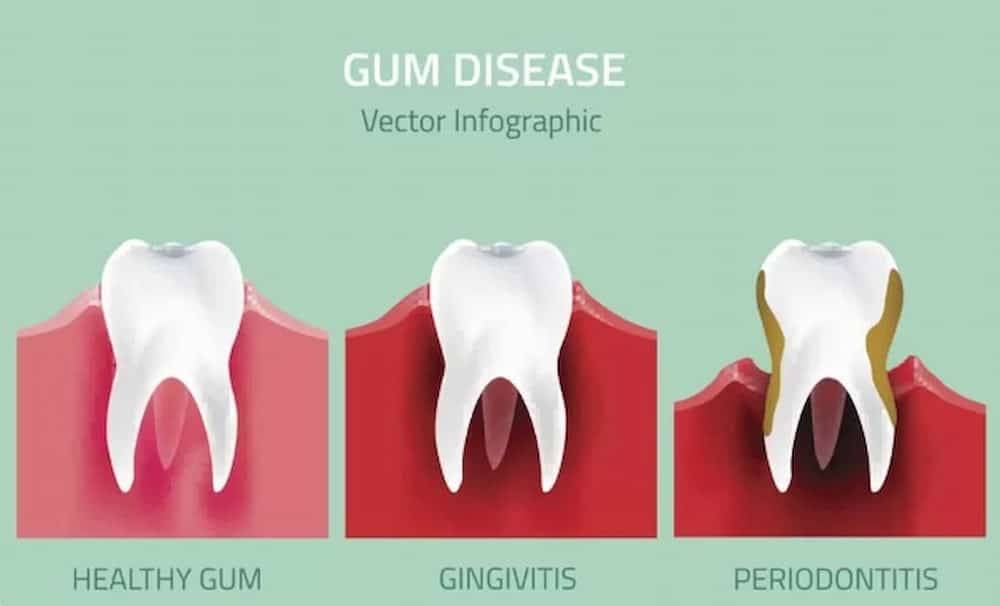 gum disease ear and tooth pain