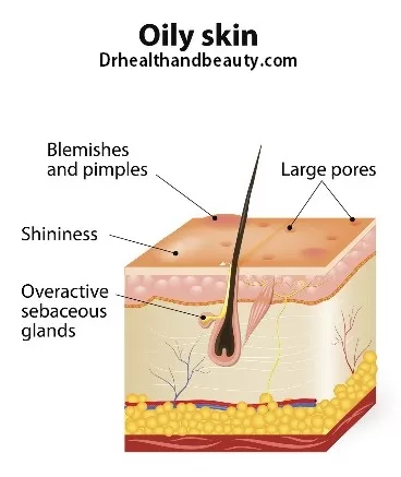 oily skin