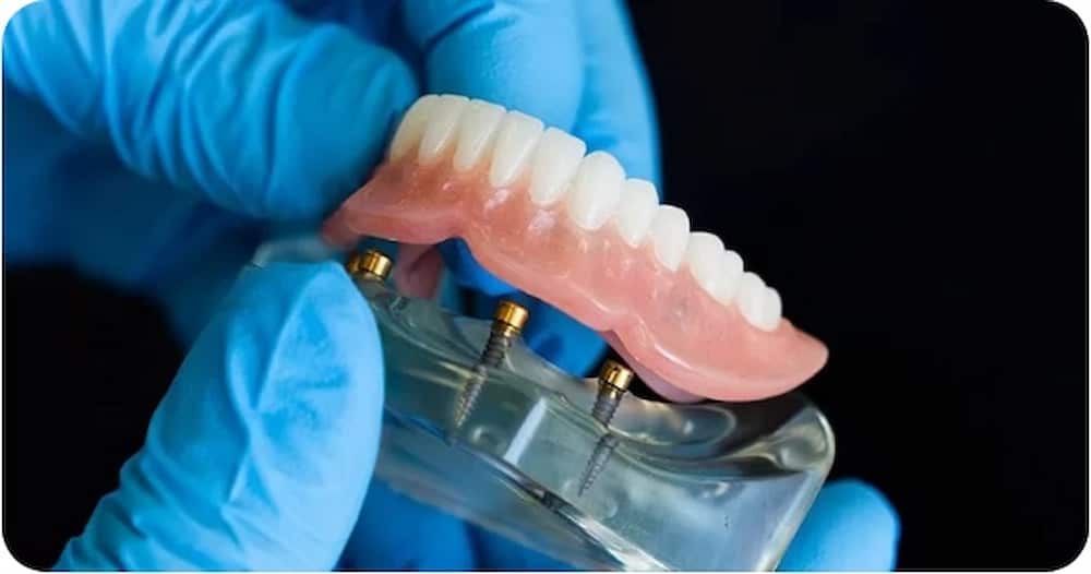 Teeth Implants in the Snap-In prosthesis method 001