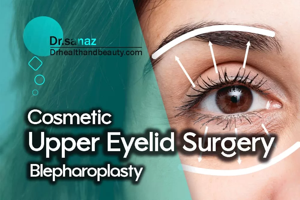 Cosmetic Upper Eyelid Surgery/Blepharoplasty