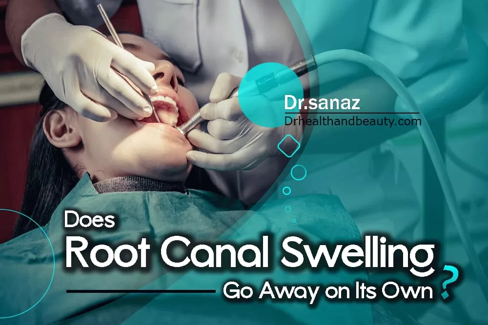 Does Root Canal Swelling Go Away on Its Own?