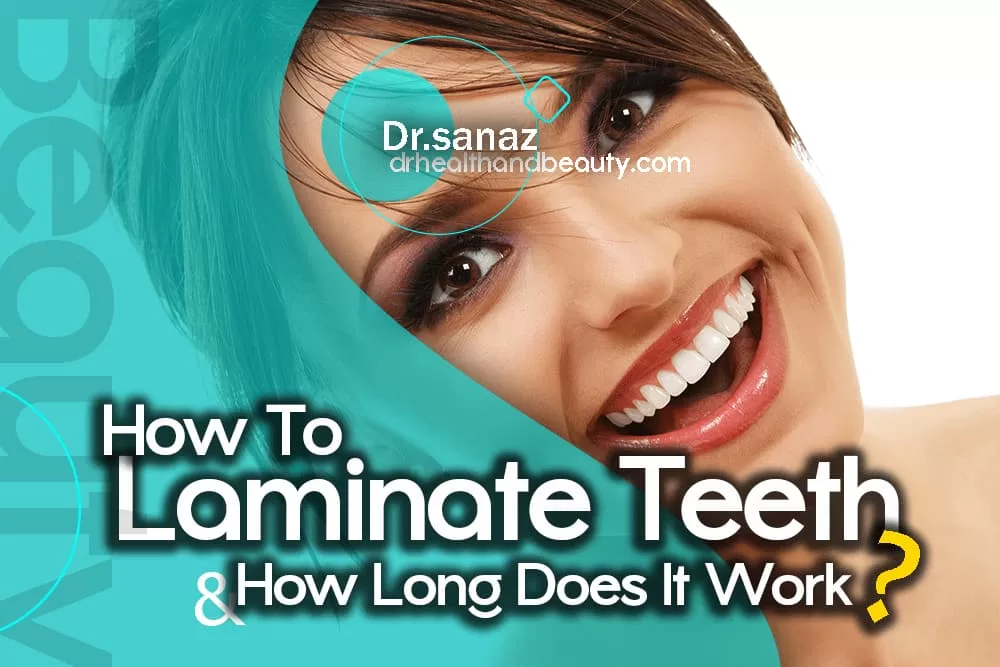 How To Laminate Teeth And How Long Does It Work?