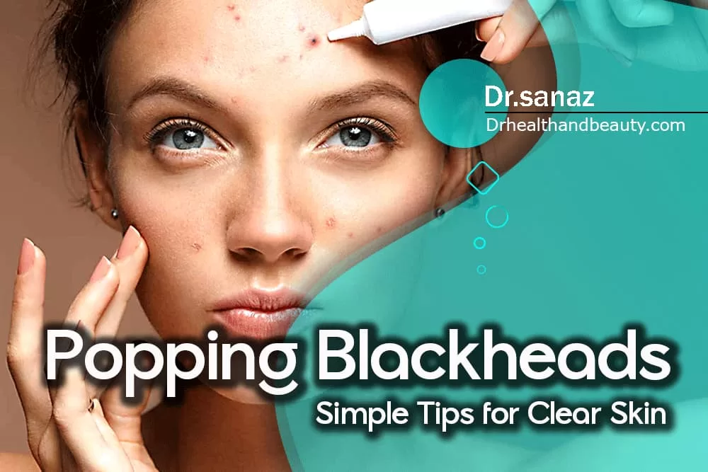 Popping Blackheads: Simple Tips for Clear Skin