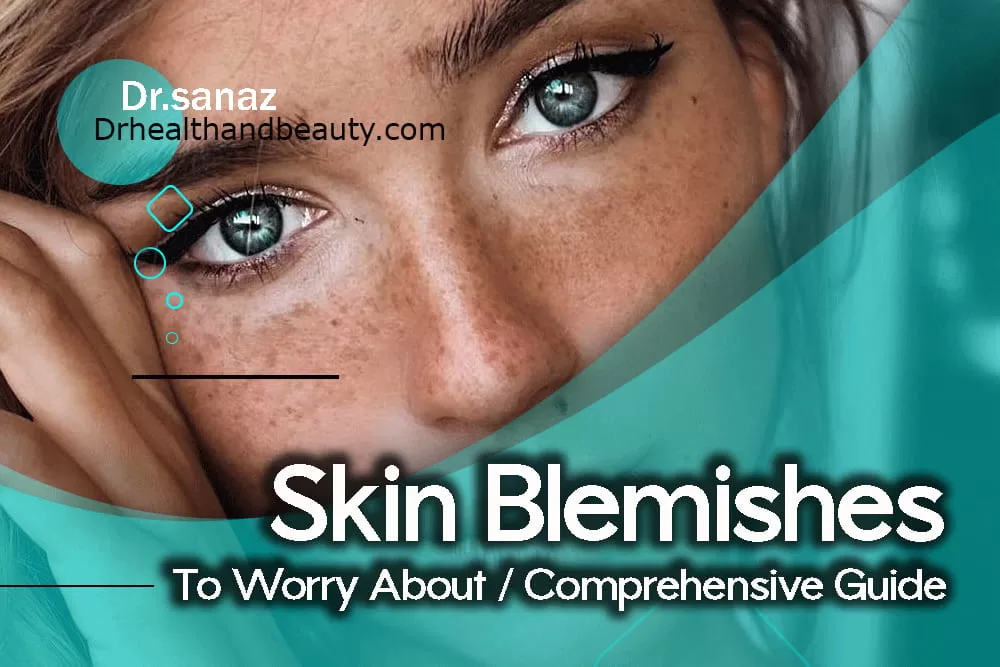 Skin Blemishes To Worry About/ Comprehensive Guide 02