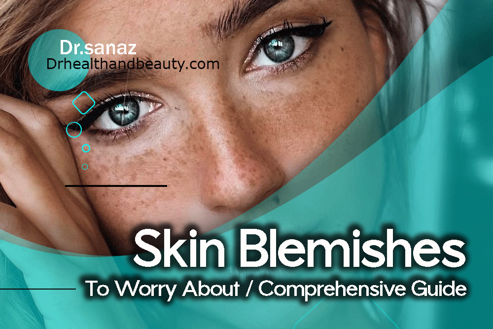 Skin Blemishes To Worry About/ Comprehensive Guide