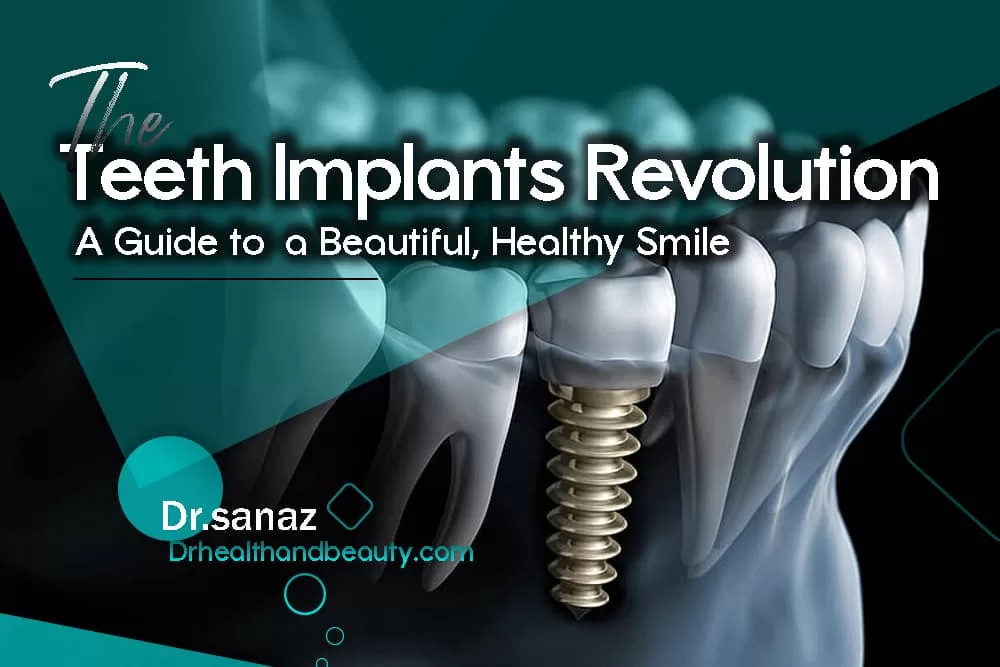 The Teeth Implants Revolution: A Guide to a Beautiful, Healthy Smile