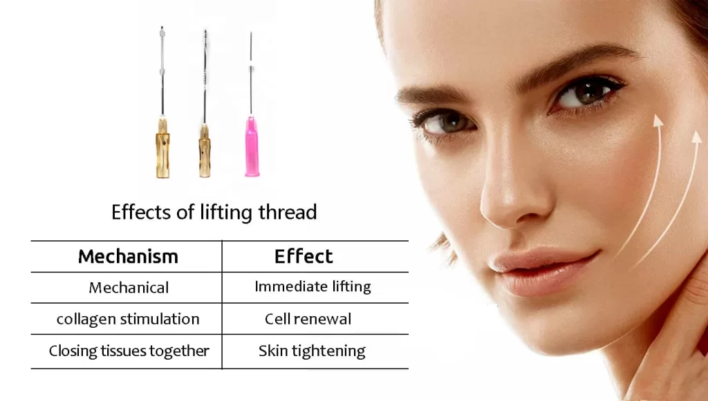 A Painless Facelift: Discover PDO Thread Lift Today! 1