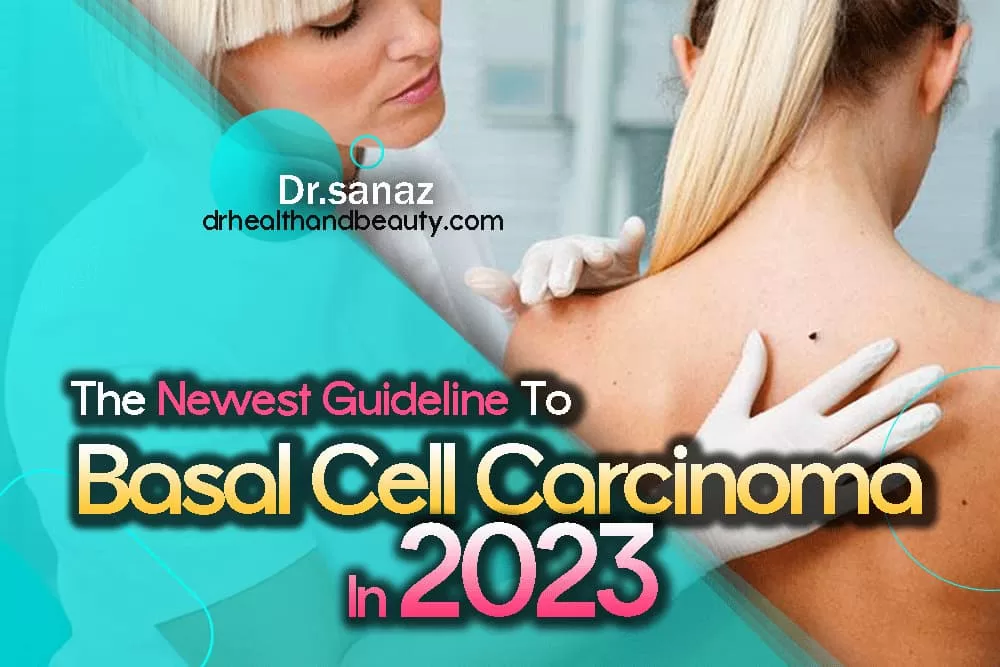 the newest guideline-to basal cell carcinoma in 2023