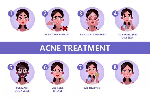 Acne treatment tips