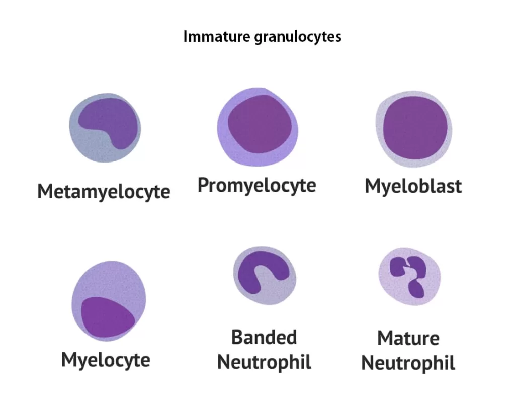 Immature granulocytes