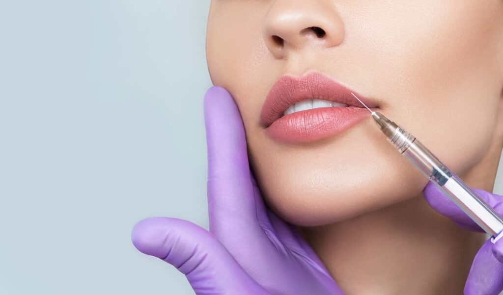 lip lifts with Botox
