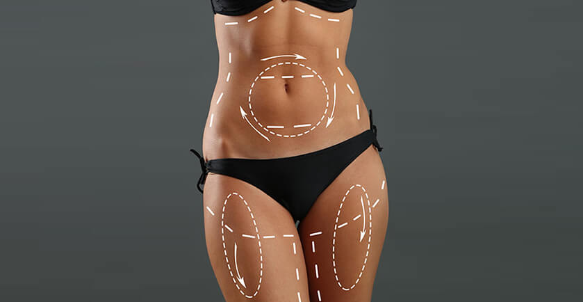 What-Are-The-Side-Effects-Of-Liposuction-Surgery 03
