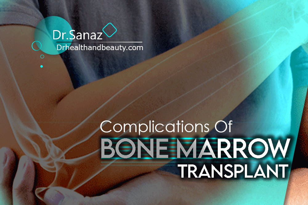 Complications-Of-Bone-Marrow-Transplant