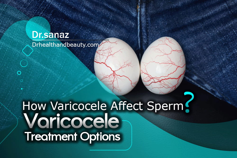 Varicocele-Treatment-Options (1)