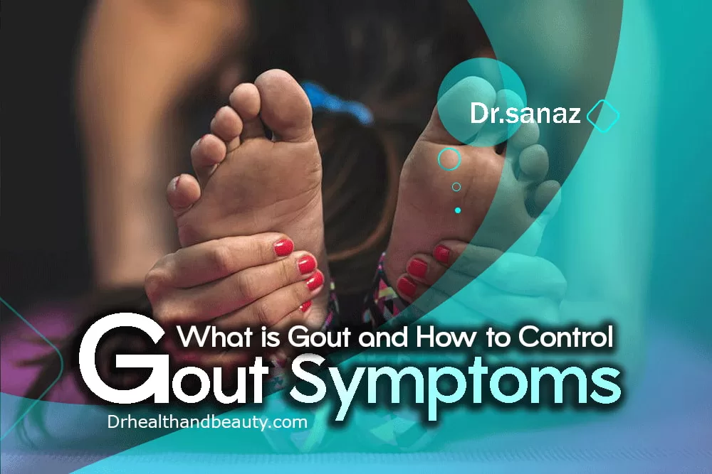 What is Gout and How to Control Gout Symptoms