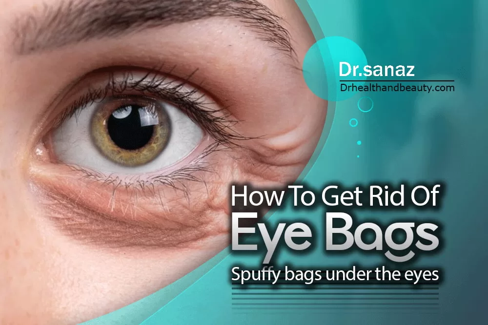 How To Get Rid Of Eye Bags (Spuffy Bags Under The Eyes )