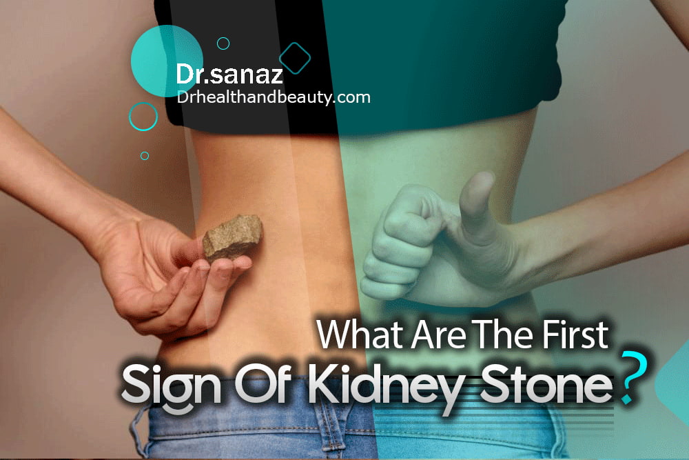 what-are-the-first-sign-of-kidney-stone? the hidden danger