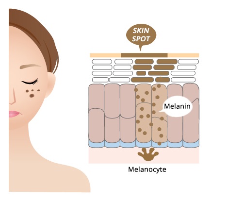 melanins and skin spots