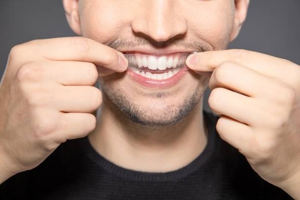 Whitening strips and Teeth-Whitening