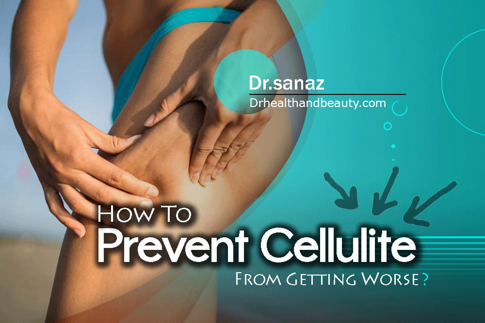 How-To-Prevent-Cellulite-From-Getting-Worse (1)