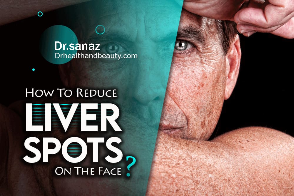 How To Reduce Liver Spots On The Face?