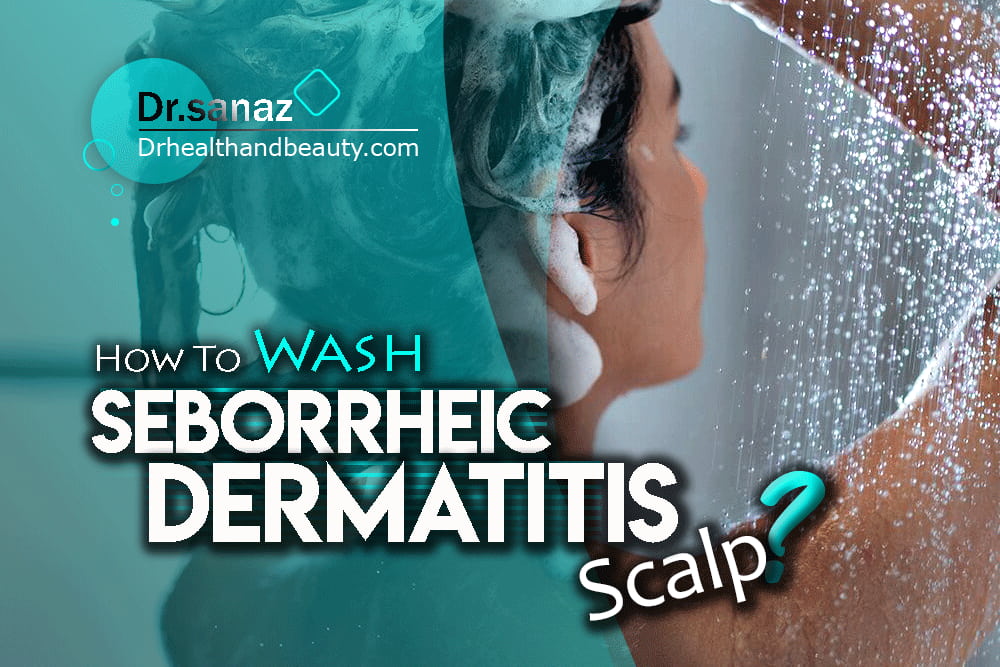 How To Wash Seborrheic Dermatitis Scalp?
