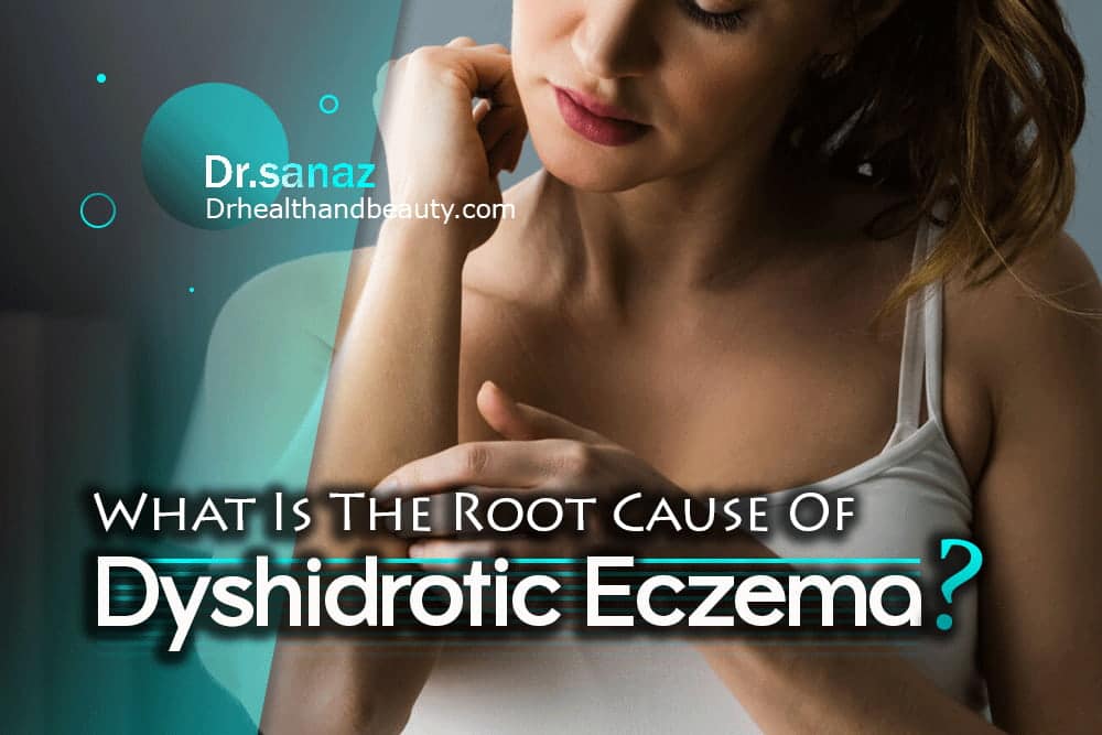 What Is The Root Cause Of Dyshidrotic Eczema?