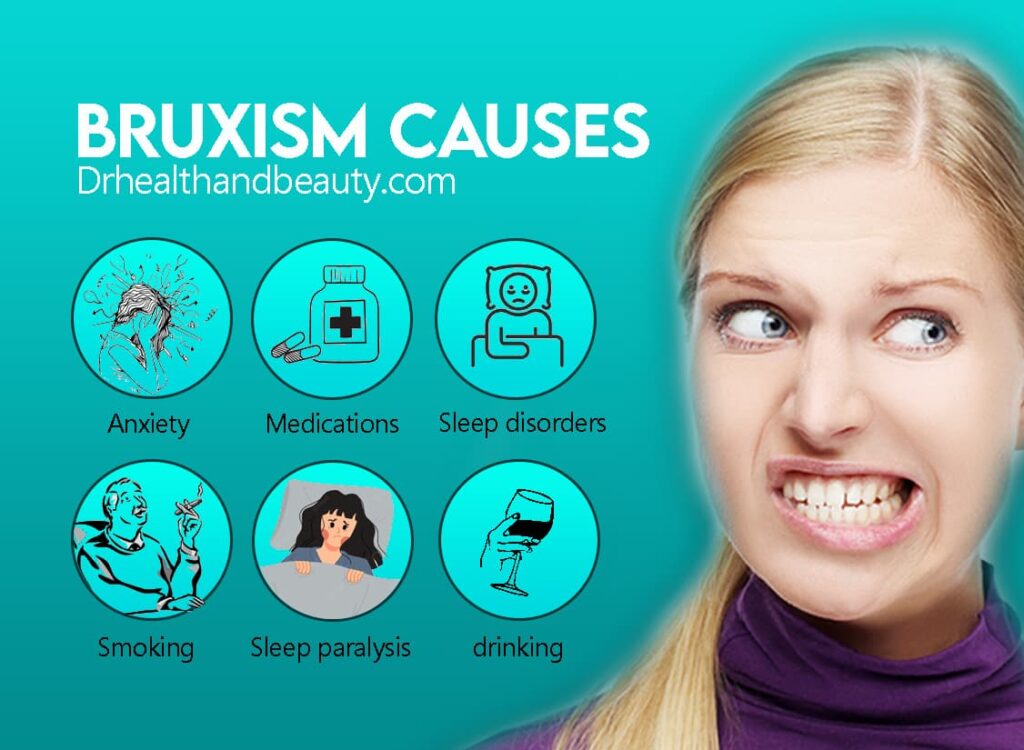 causes of bruxism