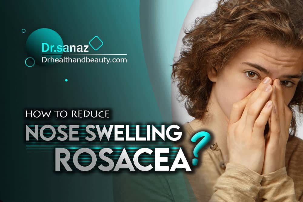 how-to-reduce-nose-swelling-rosacea