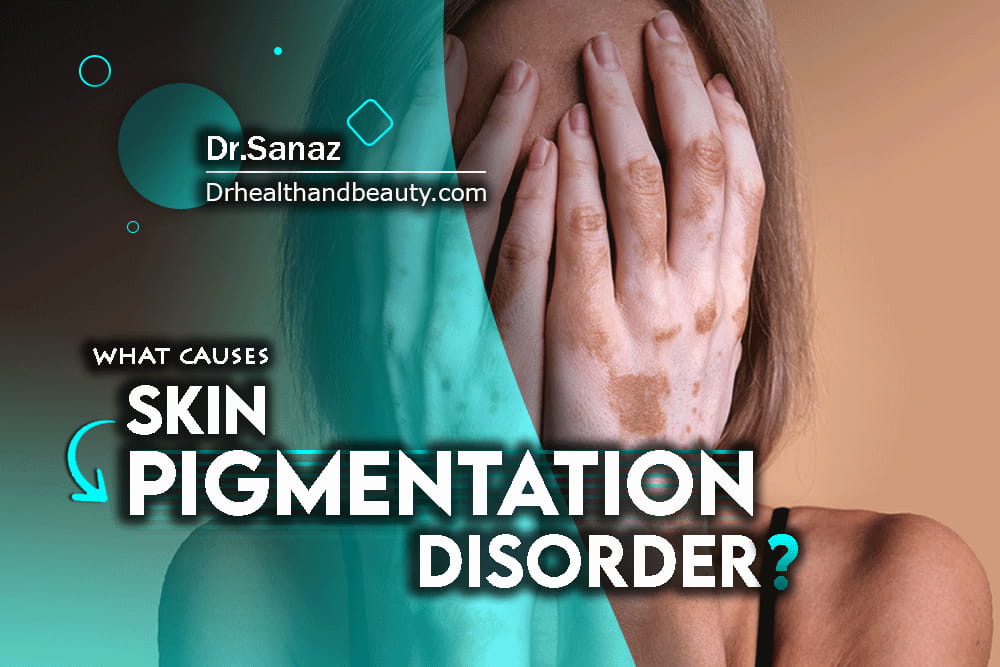 What Causes Skin Pigmentation Disorder?