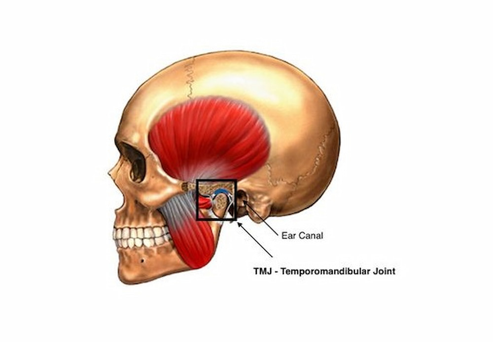 TMJ or jaw joint disorder