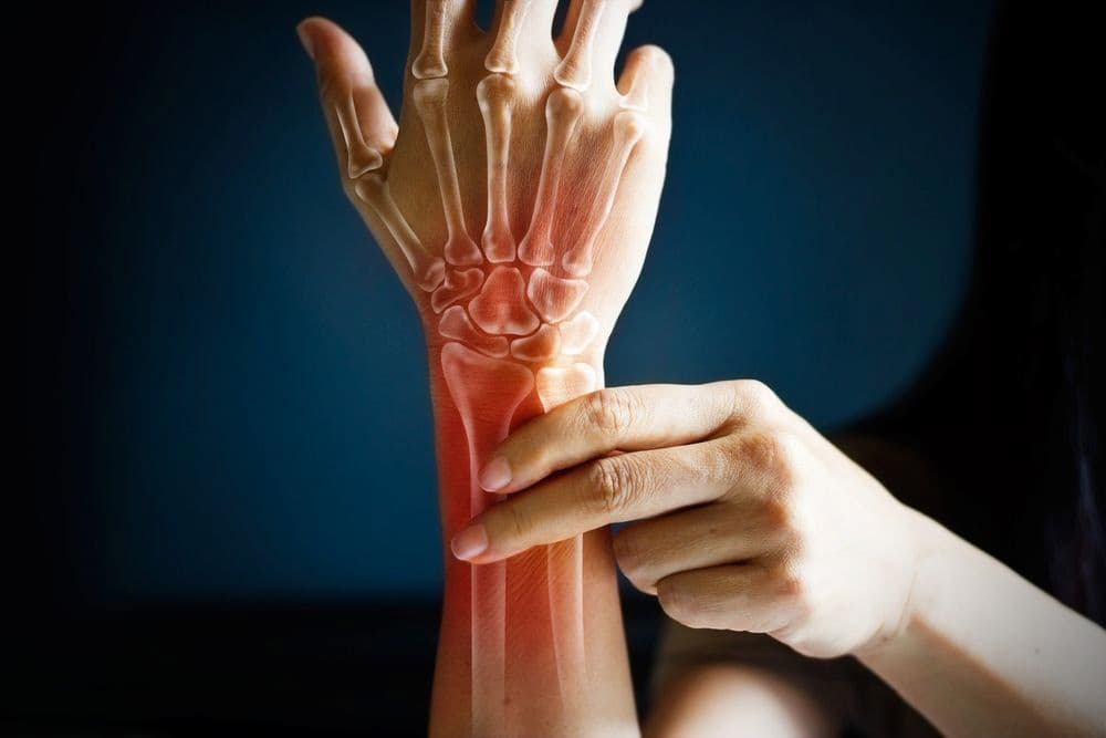 Arthritis of the wrist