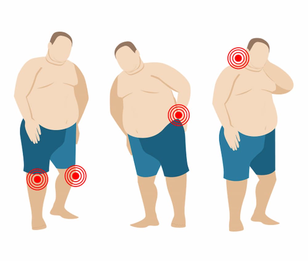 Obesity and joint pain
