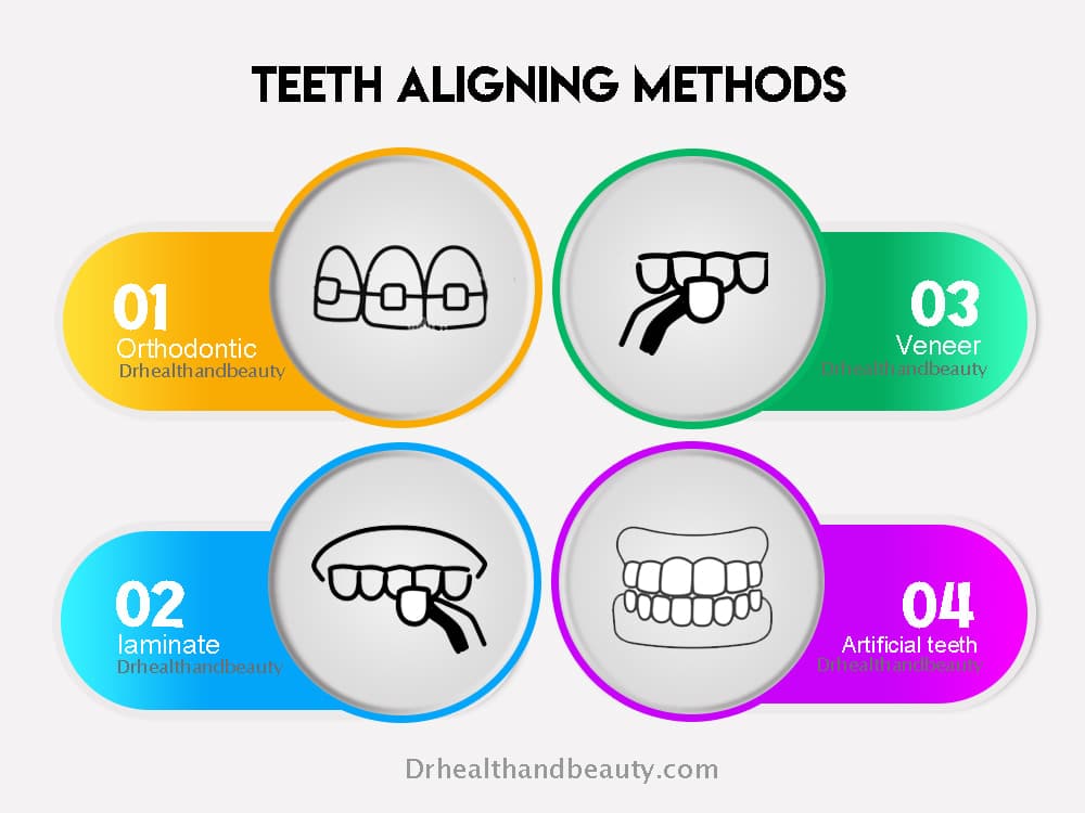 teeth aligning methods