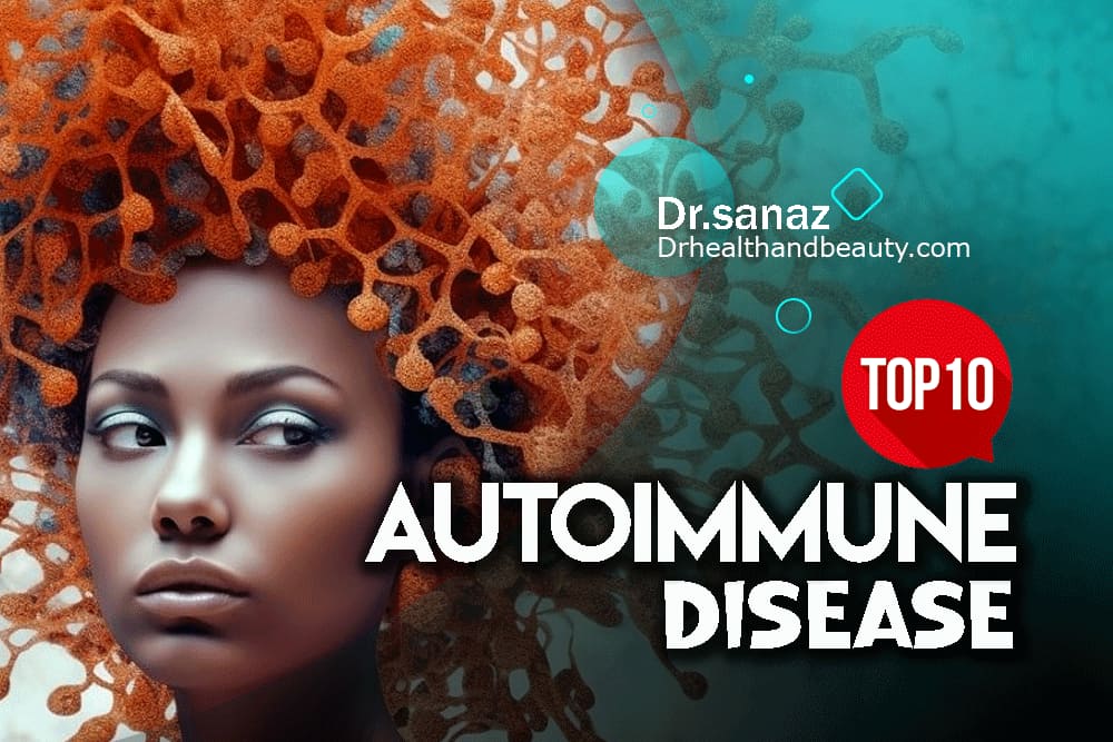 Top 10 Autoimmune-Disease