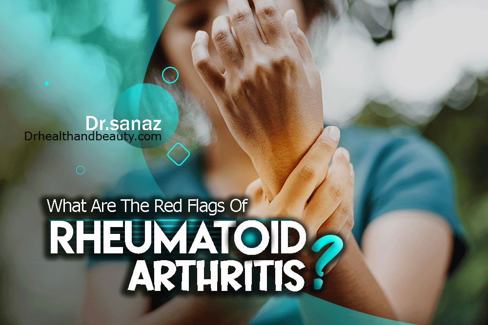 What Are The Red Flags Of Rheumatoid Arthritis?