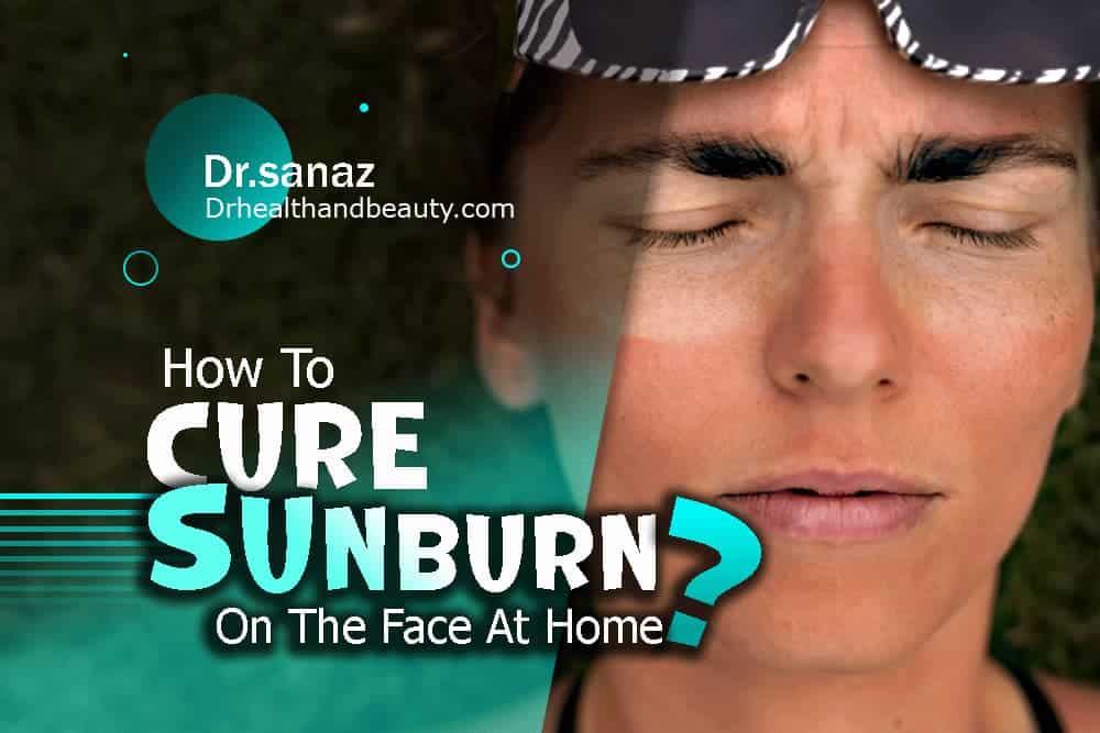 How To Cure Sunburn On The Face At Home