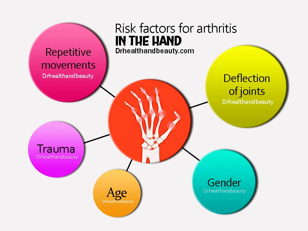 risk factors for arthritis in the hand