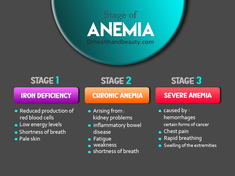 stages of anemia