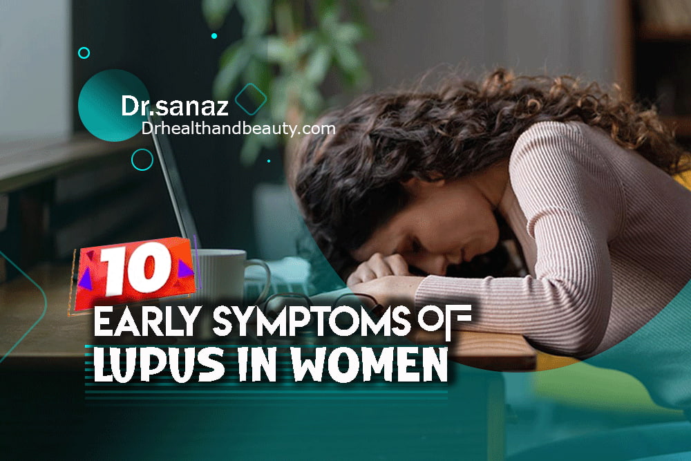 10 early symptoms of lupus in women
