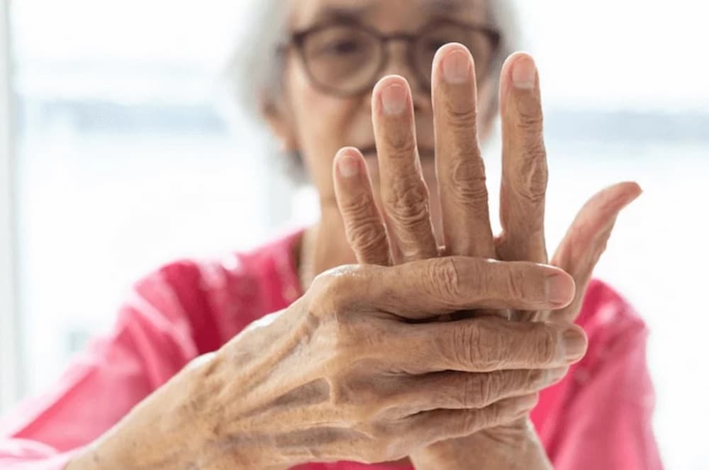 Rheumatoid arthritis diagnosis 02