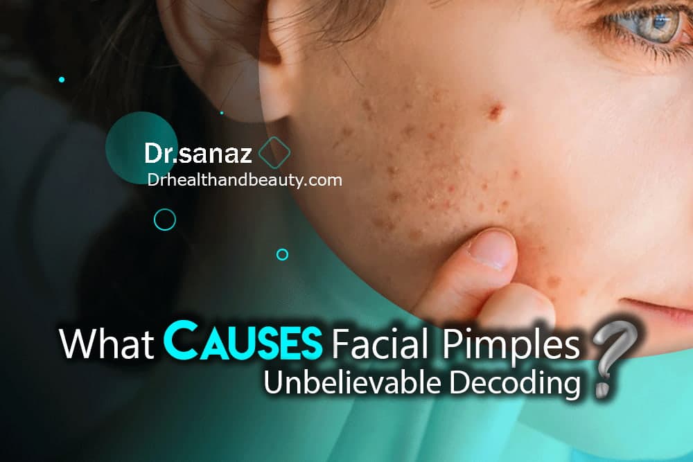 What causes facial pimples? Unbelievable Decoding