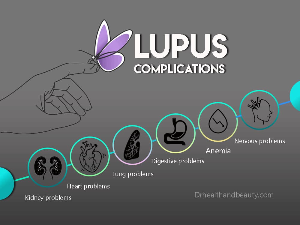 LUPUS-COMPLICATIONS