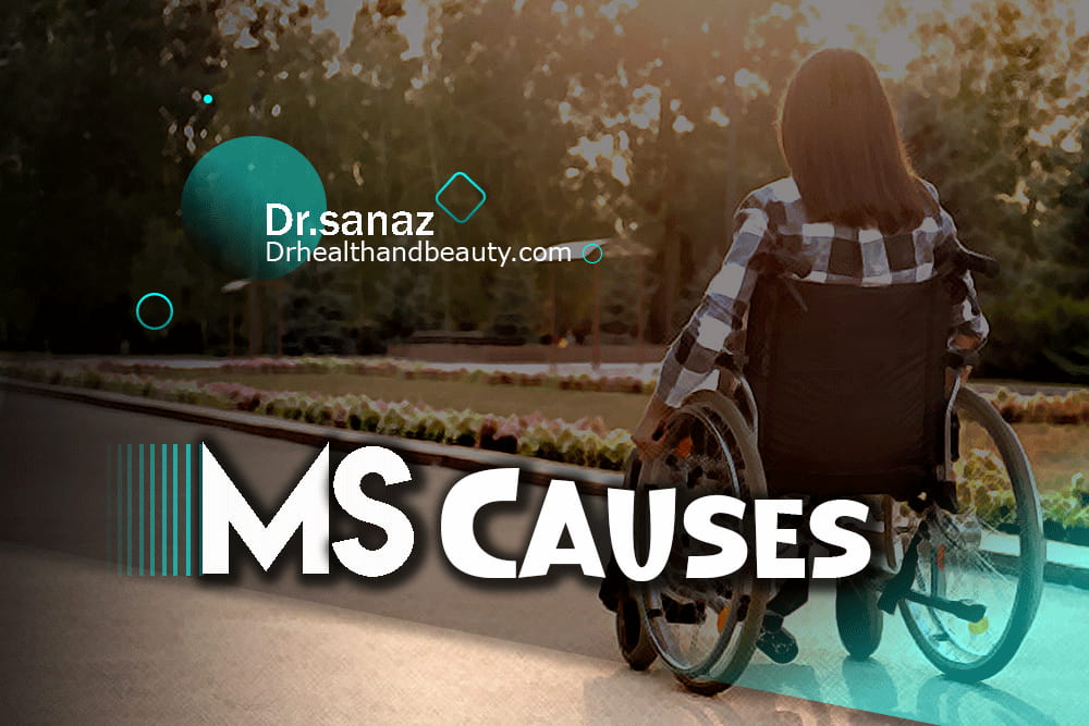 What Causes MS? Unveiling The Mystery