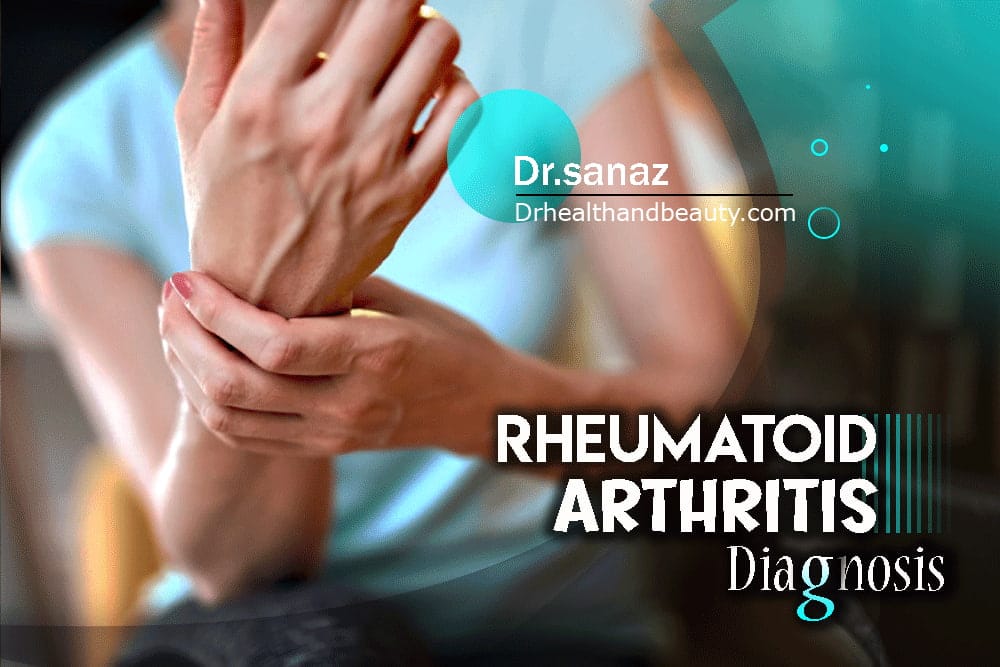 Rheumatoid-Arthritis-Diagnosis